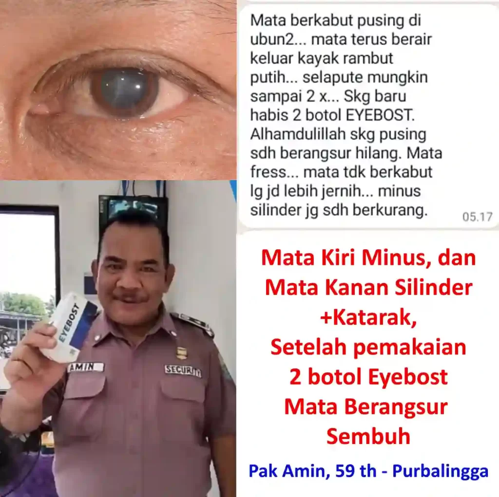 Testi-satpam.webp